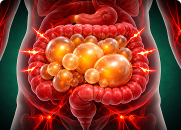 Bloating Isn't Always “Normal”